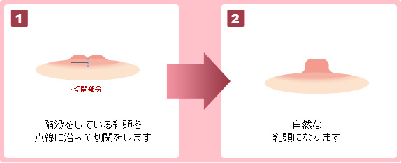 自然な形になります