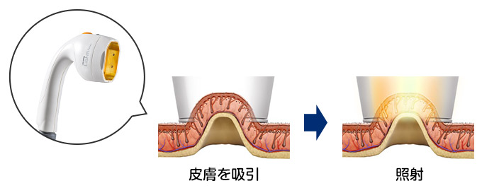 ライトシェア HS