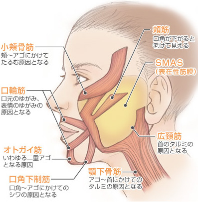 フェイスリフトとは