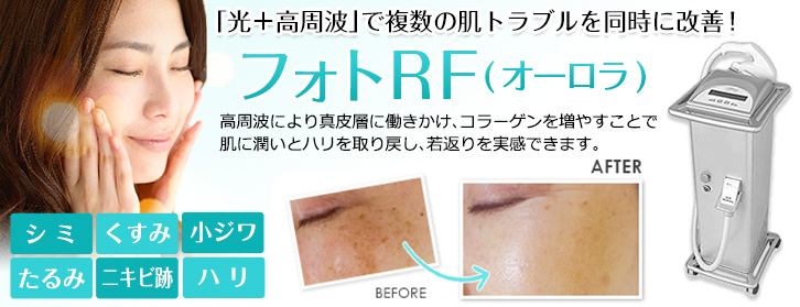 フォトRF（オーロラ）