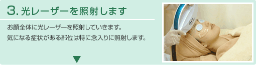 光レーザーを照射します