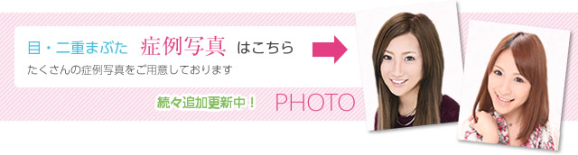 二重まぶた・目の症例写真はこちら