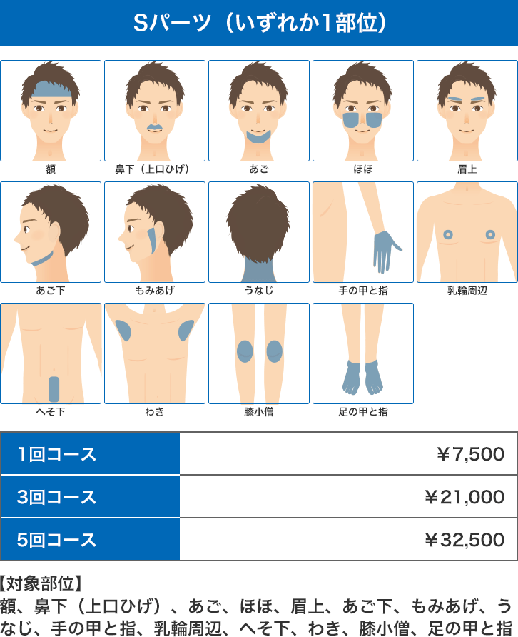 医療レーザー脱毛 男性Sパーツ：額、鼻下（上口ひげ）、あご、ほほ、眉上、あご下、もみあげ、うなじ、手の甲と指、乳輪周辺、へそ下、わき、膝小僧、足の甲と指のいずれか一部位