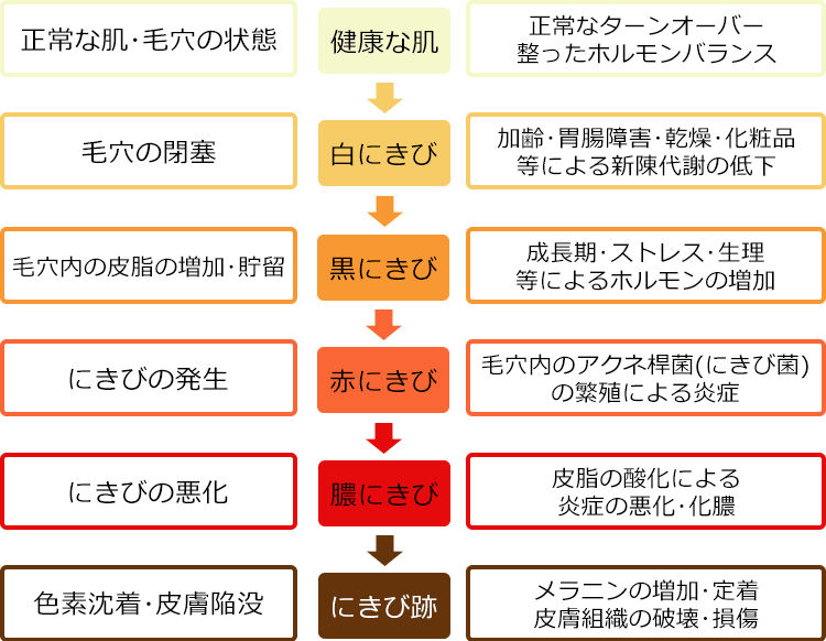 にきびの進行段階